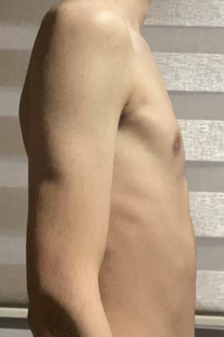 Ben after posture coaching, improved alignment