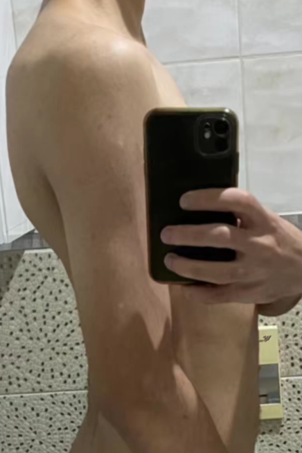 Ben before posture coaching, extreme lower back arch